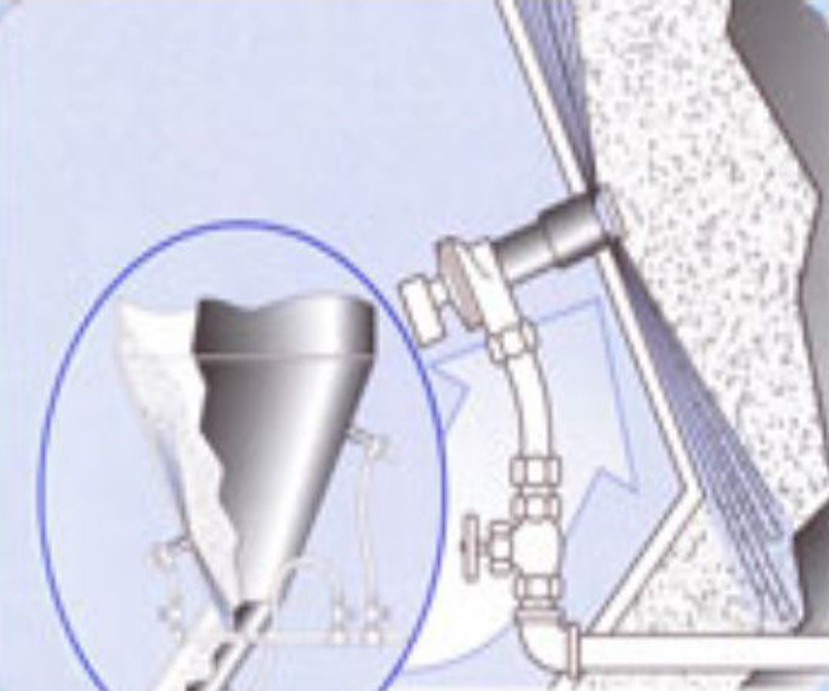 other leads